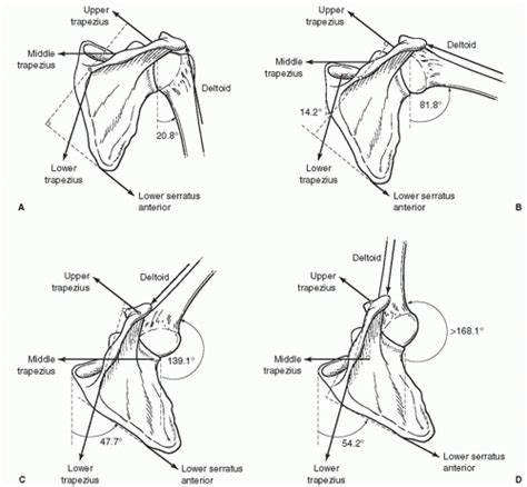 Disorders Of The Scapula Winging And Snapping Musculoskeletal Key