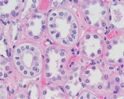 Simple Cuboidal Epithelium Diagram Quizlet