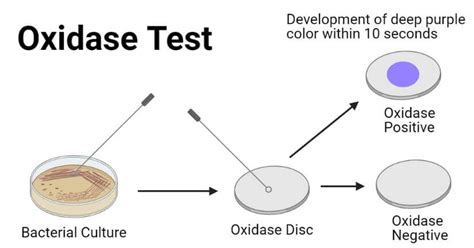 Oxidase Test Principle Procedure And Results Medical Laboratory