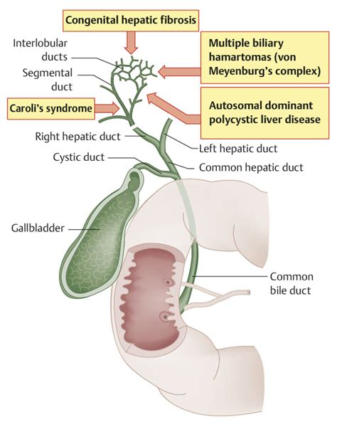 Gallbladder And Biliary Tract Radiology Key