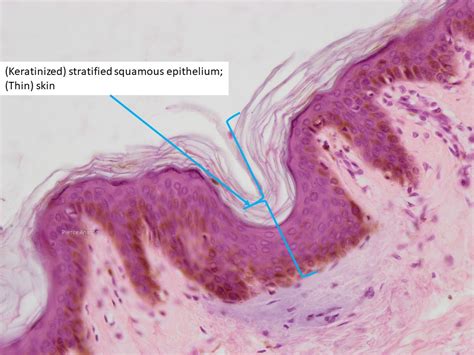 Stratified Squamous Epithelium Keratinized Skin