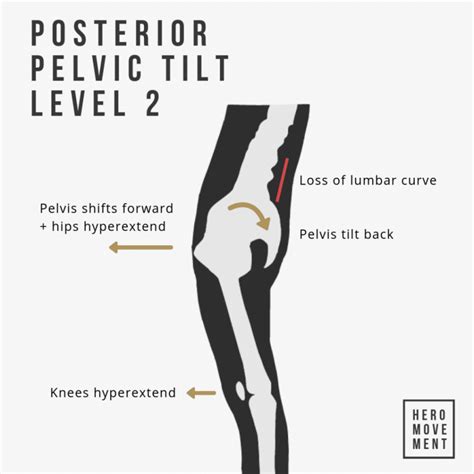 How To Fix Posterior Pelvic Tilt Guide Routine Hero Movement