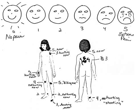 History Of The Wong Baker Faces® Pain Rating Scale Wong Baker Faces