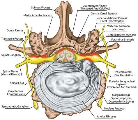 Disc Anatomy 2 Ainsworth Institute