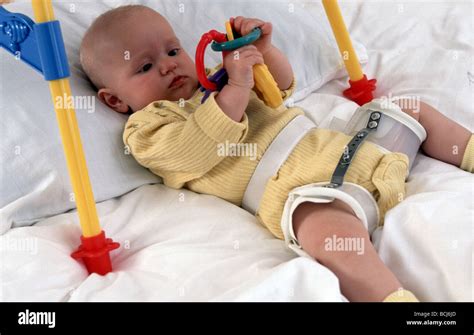 Young Baby With Hip Dysplasia Splint Pla With Toy Lay On Back Ddh