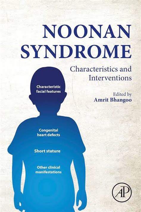 Symptoms If Noonan S Syndrome MEDizzy