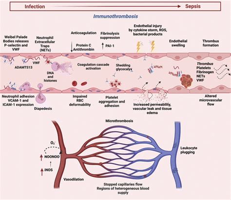 Sepsis Pathophysiology Diagram