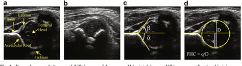 Figure 1 From Automatic Evaluation Of Scan Adequacy And Dysplasia