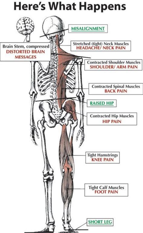 Addressing Hip Hike And Lateral Pelvic Tilt A Deep Dive Guide R