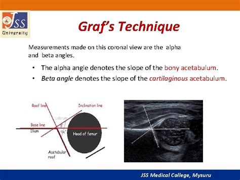 Hip Ultrasonography In Infants Children And Authors Alka