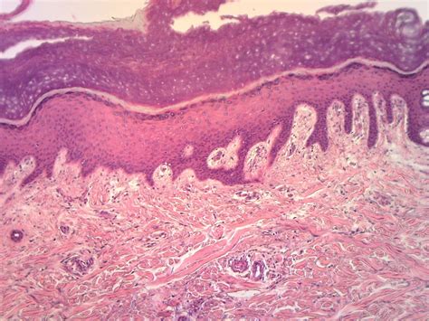 Stratified Squamous Epithelium Location