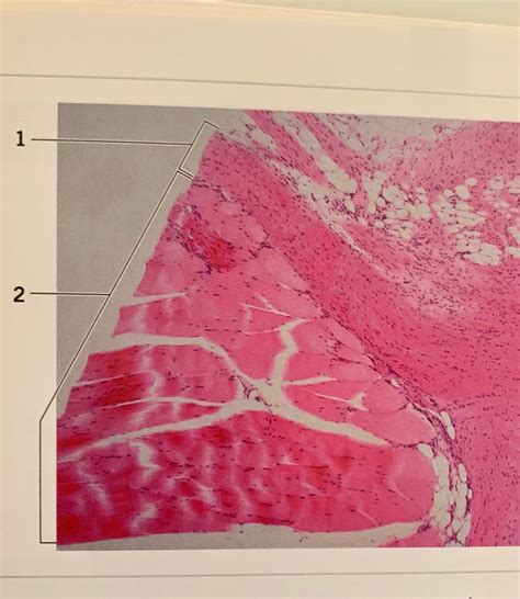 Fibrous Connective Tissues PT Flashcards Memorang