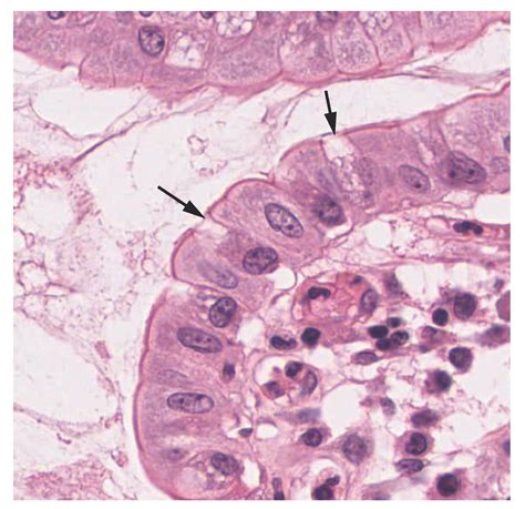 Is Glandular An Epithelial Tissue At Roxie Patterson Blog