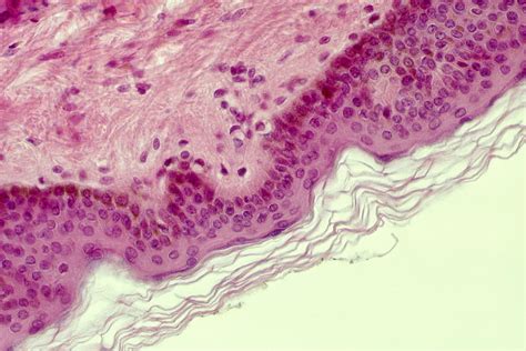 Stratified Squamous Epithelium Location