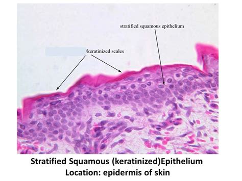 Keratinized Stratified Squamous Epithelium Location And Function Log