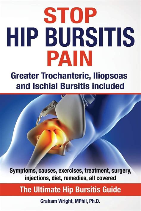 Best Exercises For Hip Bursitis Video Included Artofit