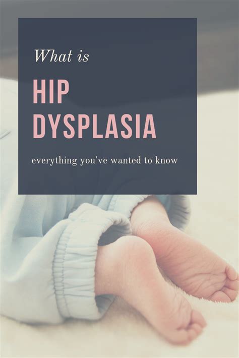 Everything Youve Wanted To Know About Hip Dysplasia And Baby Wearing