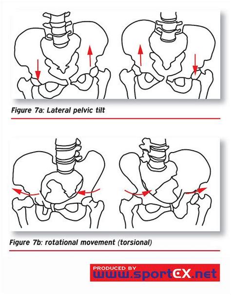 Lateral Pelvic Tilt Biomecânica Fisio Fisioterapia