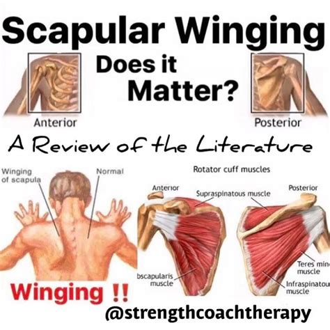 Anatomy Of Scapular Winging