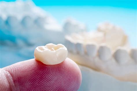 What Are The Different Types Of Dental Crowns Kensington Md