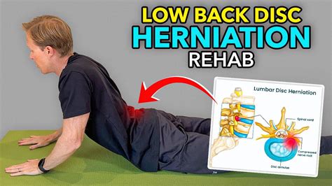 3 Exercises For A Low Back Lumbar Disc Bulge YouTube