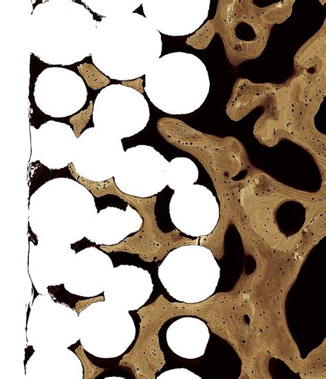 Woven bone is found on the growing ends of an immature skeleton or, in adults, at the site of a healing fracture. Bone Cross-section Photograph by Science Photo Library