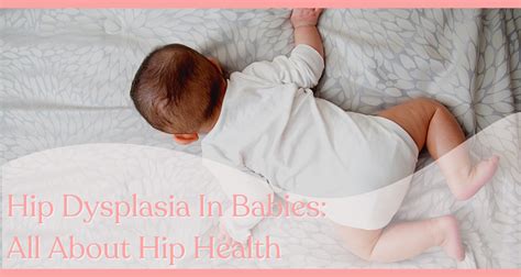 Hip Dysplasia In Babies All About The Hip Health Haus And Kinder