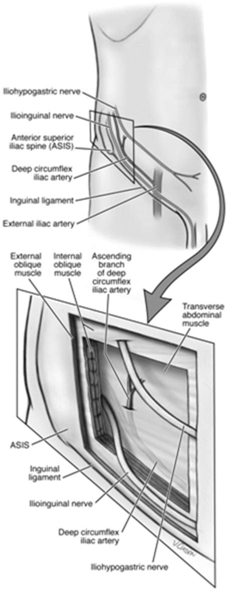 Ilioinguinal Nerve Block Anatomy