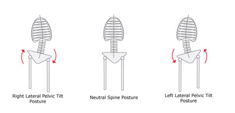 Lateral Pelvic Tilt Exercise Gray Chiropractic Stcatharines Spine