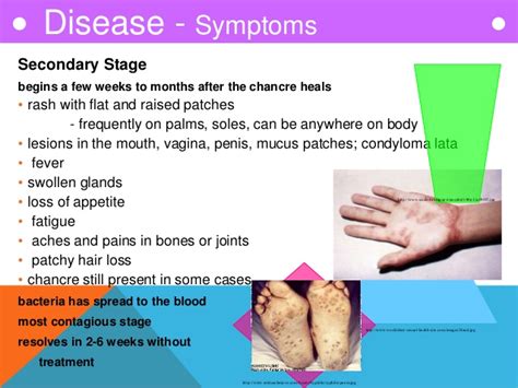 The symptoms of syphilis are not always obvious and may eventually disappear, but you'll usually remain infected unless you get treated. Untitled on emaze