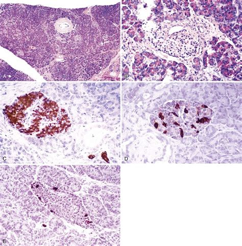 Gallbladder Extrahepatic Biliary Tract And Pancreas Tissue Processing