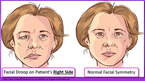 Head And Neck Assessment Nursing