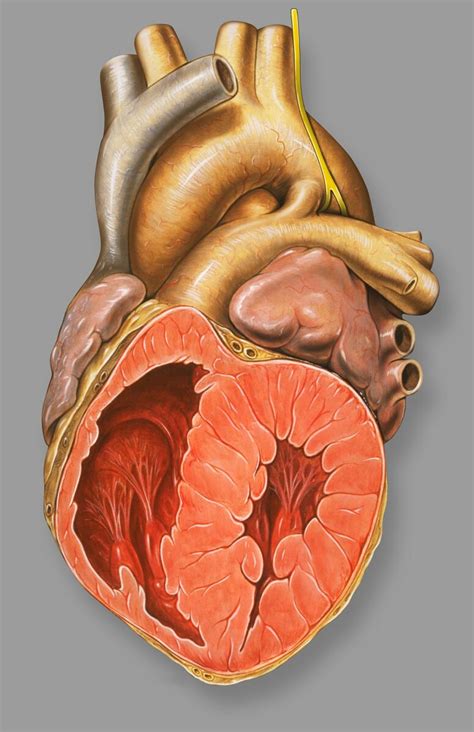 Patent Ductus Arteriosus Pda Concise Medical Knowledge