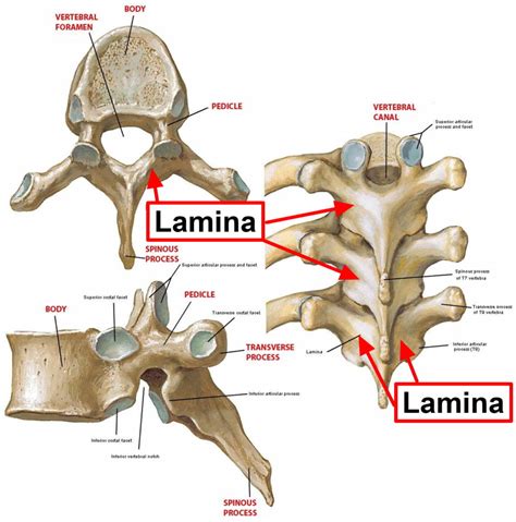 Laminectomy Surgery Recovery And Laminectomy Complications