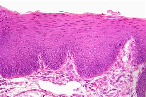 Stratified Squamous Epithelium Lm By Science Stock Photography Science