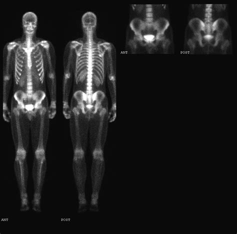 Ucsd Musculoskeletal Radiology