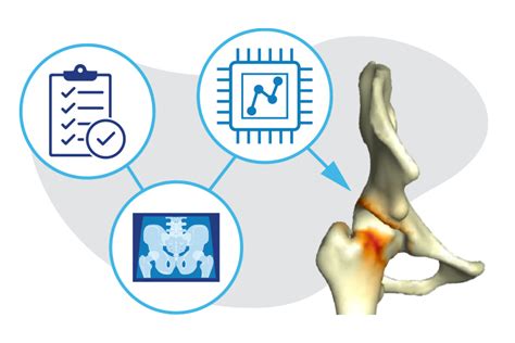 Ai And Hip Preservation Boston Childrens Answers