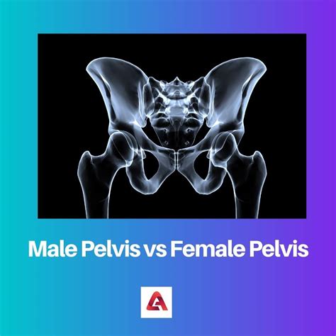 Male Pelvis Vs Female Pelvis Difference And Comparison