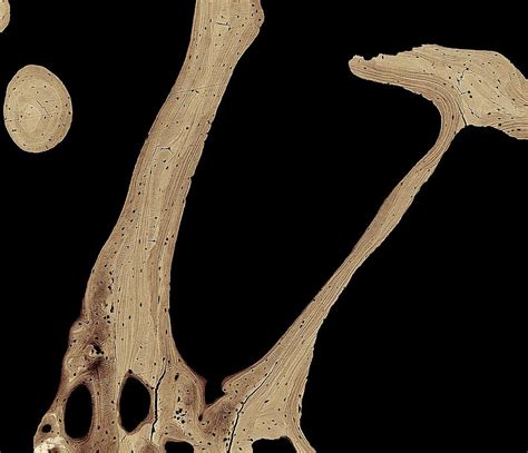 Two types of bone tissues in cross section of a long bone : Bone Cross-section Photograph by Science Photo Library