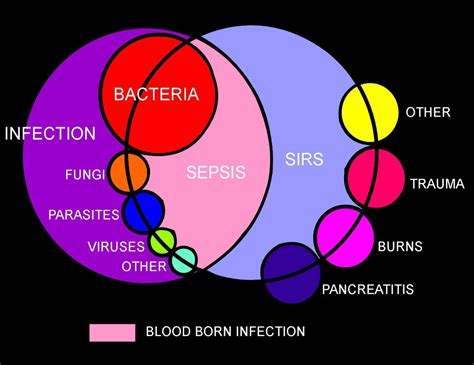 Sepsis Pathophysiology Diagram