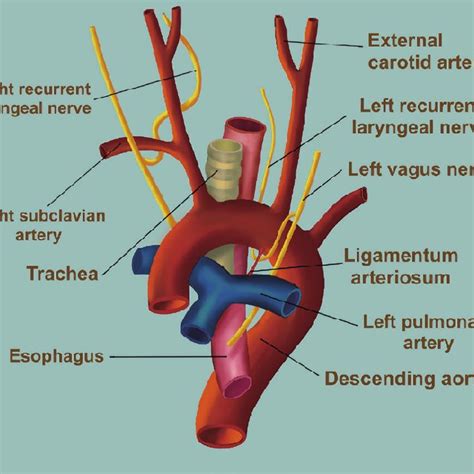 Echocardiogram Showing Persistence Of The Patent Ductus Arteriosus