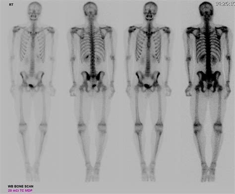 Ucsd Musculoskeletal Radiology