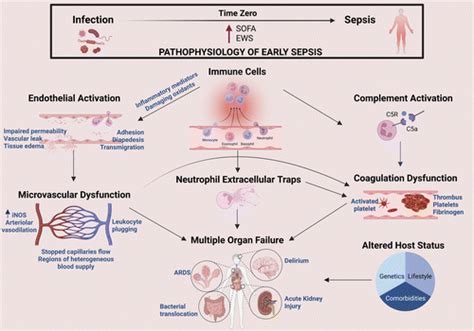 Sepsis Pathophysiology Diagram