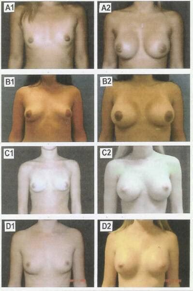 Boob Size Comparison Chart XXGASM