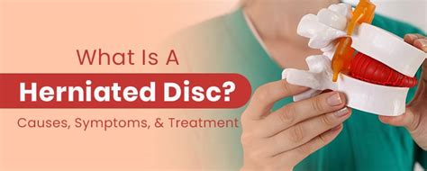 What Is A Herniated Disc Causes Symptoms Treatment