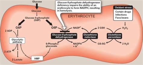 While many people with g6pd deficiency don't have any symptoms at all and live a healthy life, some have more severe cases. Glucose-6-phosphate dehydrogenase (G6PD) deficiency ...