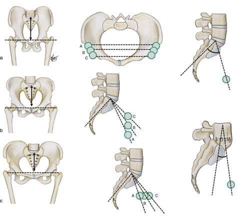 Pelvic Vertebra The Cephalic Vertebra And The Concept Of The Chain Of