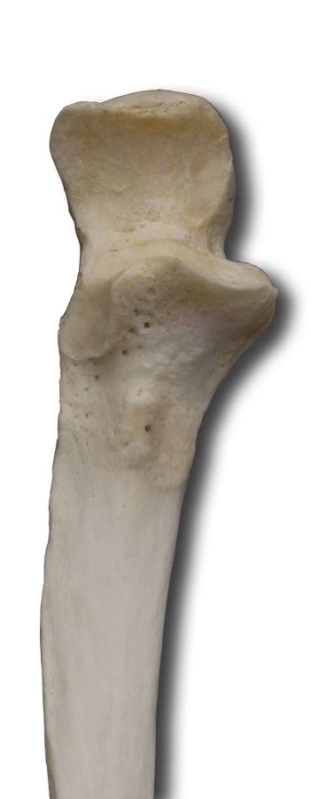 Upper Extremities Bones