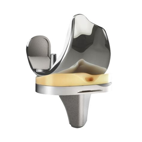 Total Knee Replacement Dr Bryan Bomberg