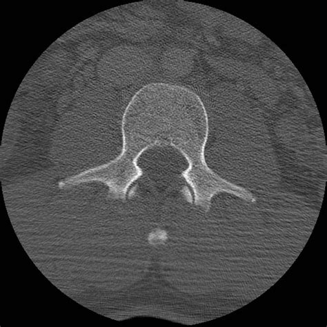 Ucsd Musculoskeletal Radiology